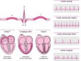 /album/fotogaleria/ecg-jpg/
