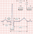 /album/fotogaleria/ecg-png/