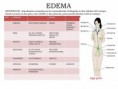 /album/fotogaleria/edema-jpg/