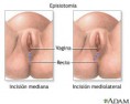 /album/fotogaleria/episiotomia-jpg/